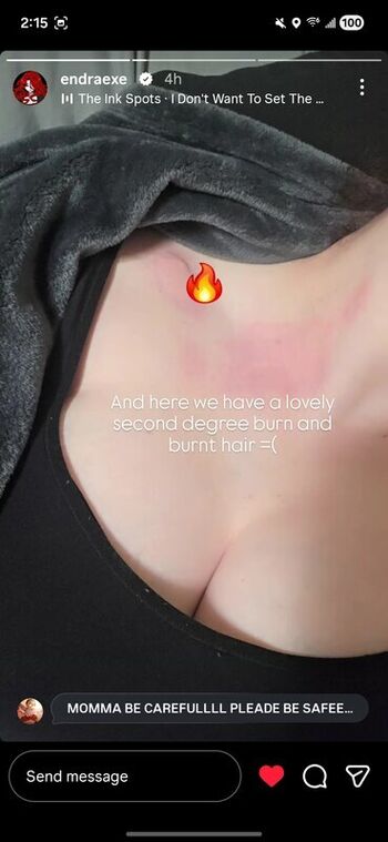 Full leaked Endra exe private onlyfans photo