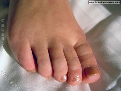 Scandinavian Feet
