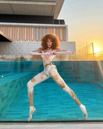 Winnie Harlow
